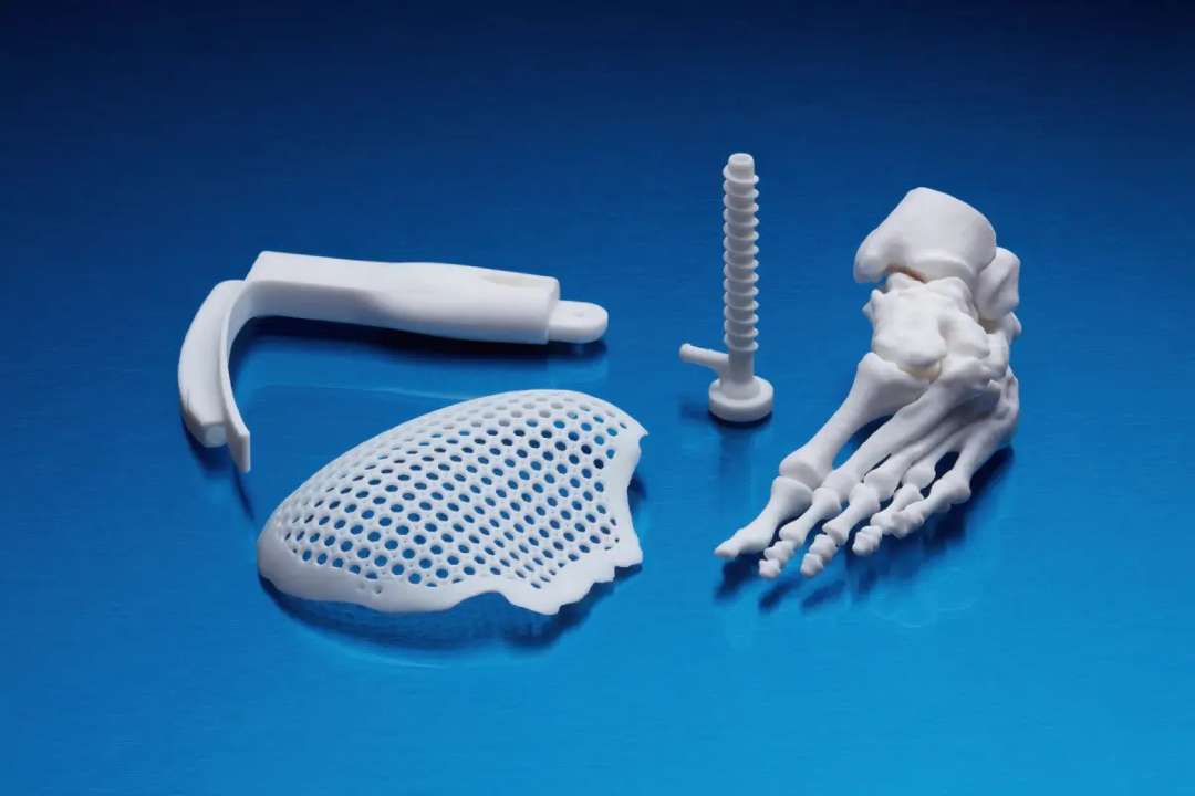 Componentes de dispositivos médicos impresos en blanco con Formlabs BioMed White Resin: guía de perforación quirúrgica, escudo de malla reticular para implante, modelo de tornillo óseo roscado y anatomía detallada del pie para planificación preoperatoria
