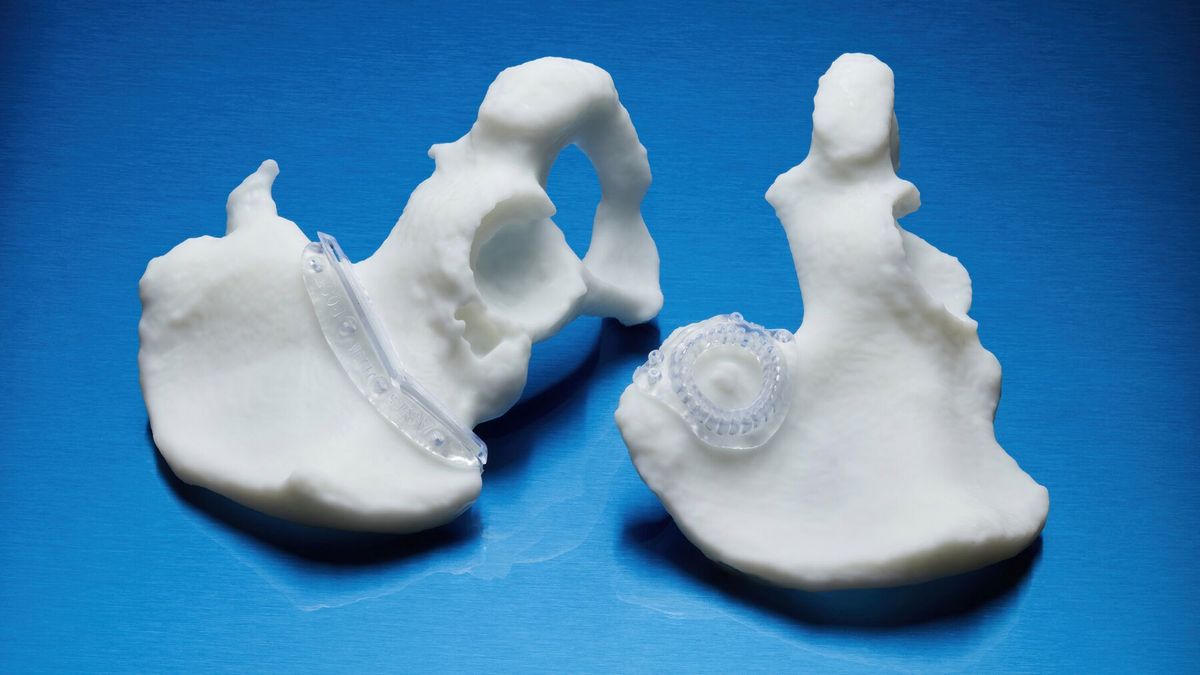 Ventajas de elegir la resina BioMed Durable para uso médico