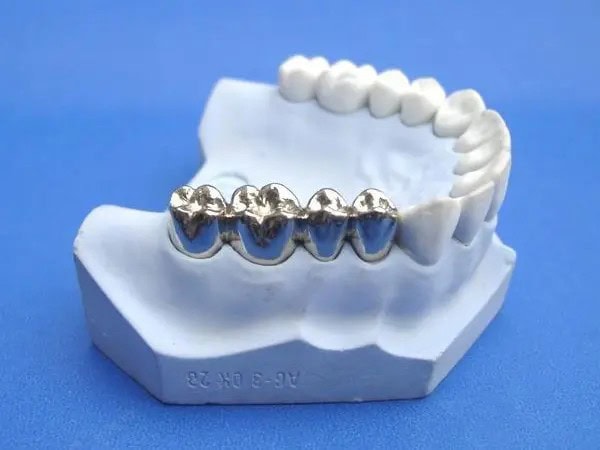 Impresión 3D metálica